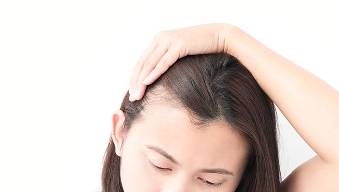 Tips to Prevent Hair Loss Naturally at Home